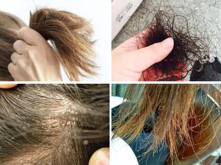 科技干发帽三分钟速干轻松告别湿哒哒！冰球突破豪华版手机版女生值得用的黑(图6)