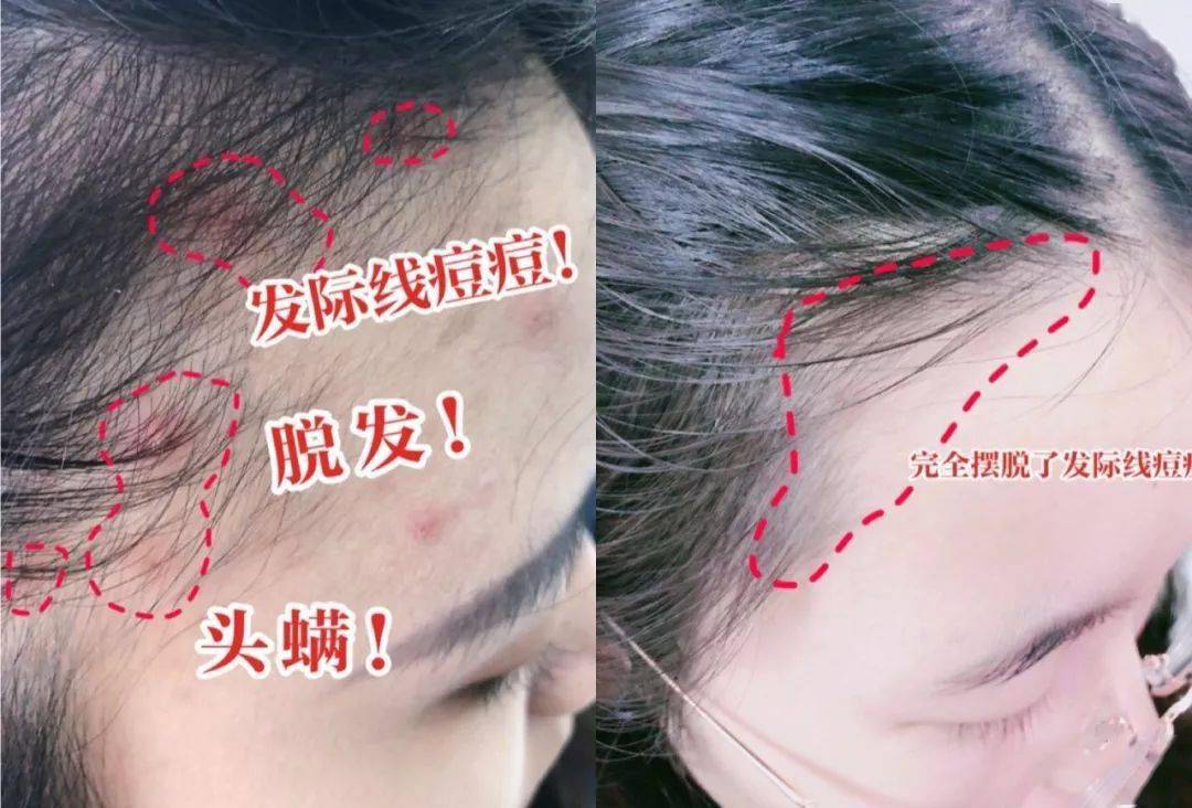 科技干发帽三分钟速干轻松告别湿哒哒！冰球突破豪华版手机版女生值得用的黑(图21)